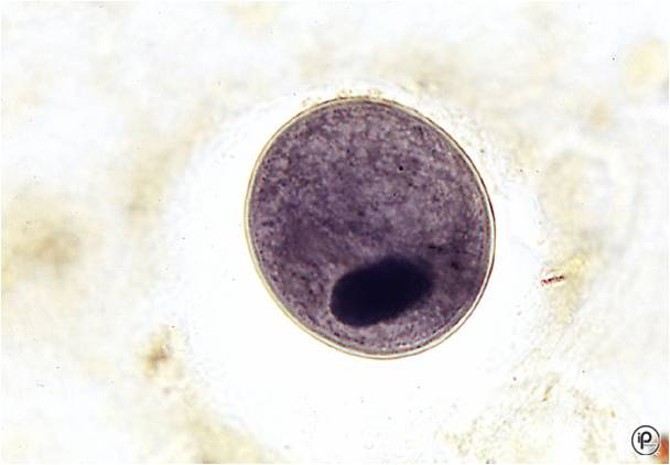 élő körömféreg élősködők férgek helminták férgek kezelése