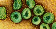 4 เรื่องต้องรู้เกี่ยวกับไวรัสเมอร์ส (MERS-CoV) 