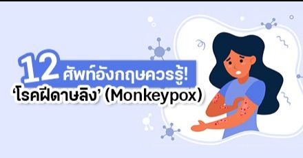 จดไว้เผื่อออกสอบ! มัดรวม 12 คำศัพท์ภาษาอังกฤษเกี่ยวกับ “โรคฝีดาษลิง” ที่เจอได้บ่อยในข่าว