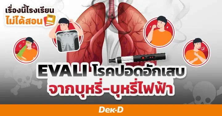 ความรู้จากข่าว! EVALI โรคปอดอักเสบจากบุหรี่-บุหรี่ไฟฟ้า (pod) ไม่ได้สูบก็เสี่ยง!