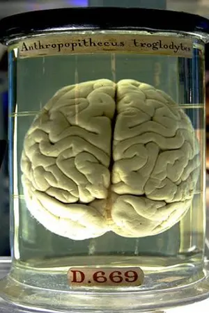 ปกนิยาย โรคแปลกๆที่คุณควรรู้ (ตอนที่1 โมยาโมยา)