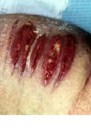 ปกนิยาย Factitious