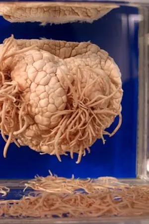 ปกนิยาย parasitosis