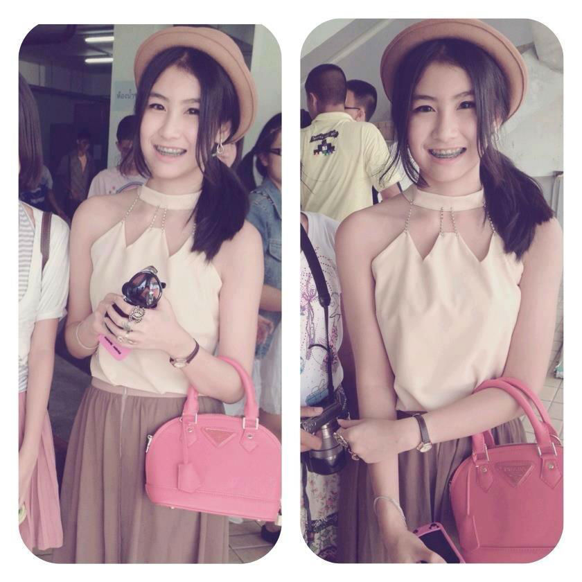 รวมรูปคนจัดฟันน่ารัก มาก !! ไม่ดูเเล้วจะเสียใจ นะ.... ค่าา | Dek-D.Com
