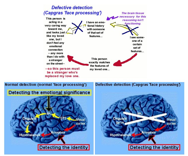 นิยาย Psychology:Mystery:Strange > ลำดับตอนที่ #13 : Capgras Syndrome ...