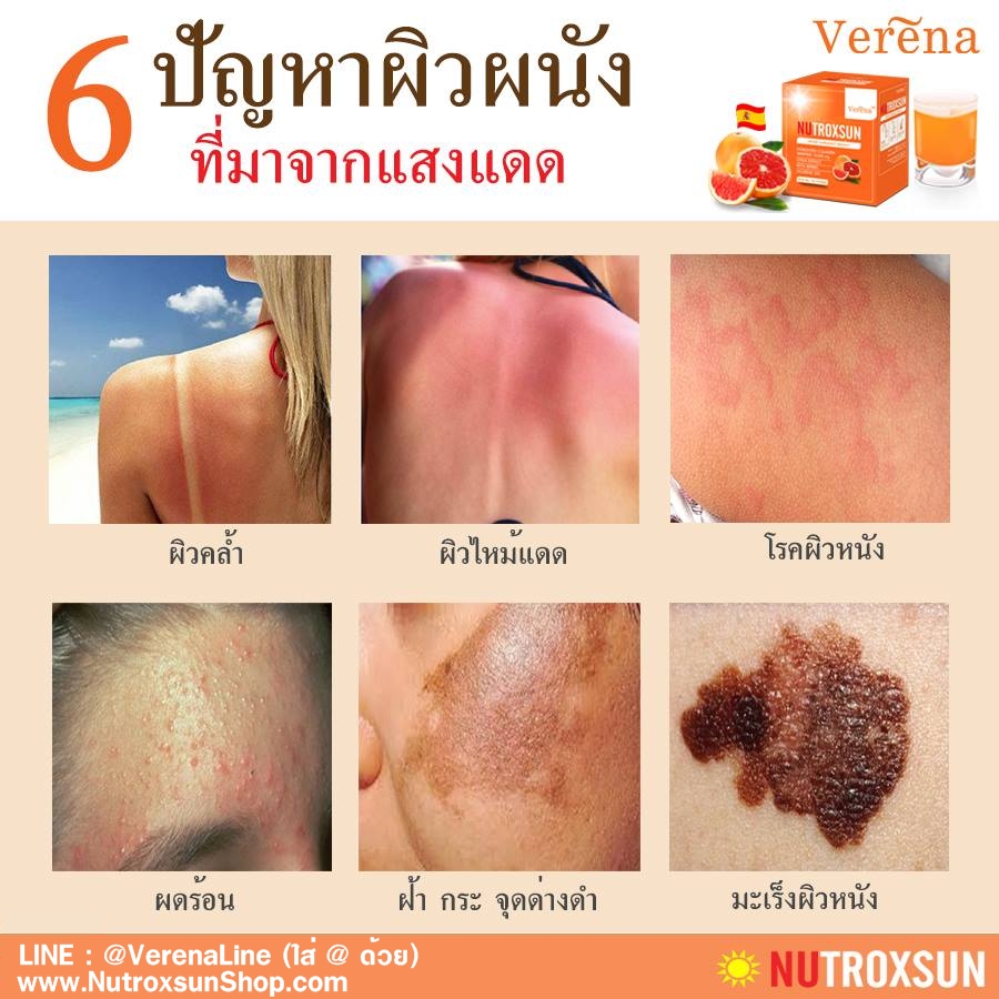 ปัญหาผิวคล้ำ จัดการได้ด้วยนูทรอกซัน ตัวช่วยบำรุงผิวขาวใส