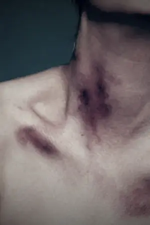 ปกนิยาย The Rebel's Surgeon หมอมึน (18+) (Ebook)