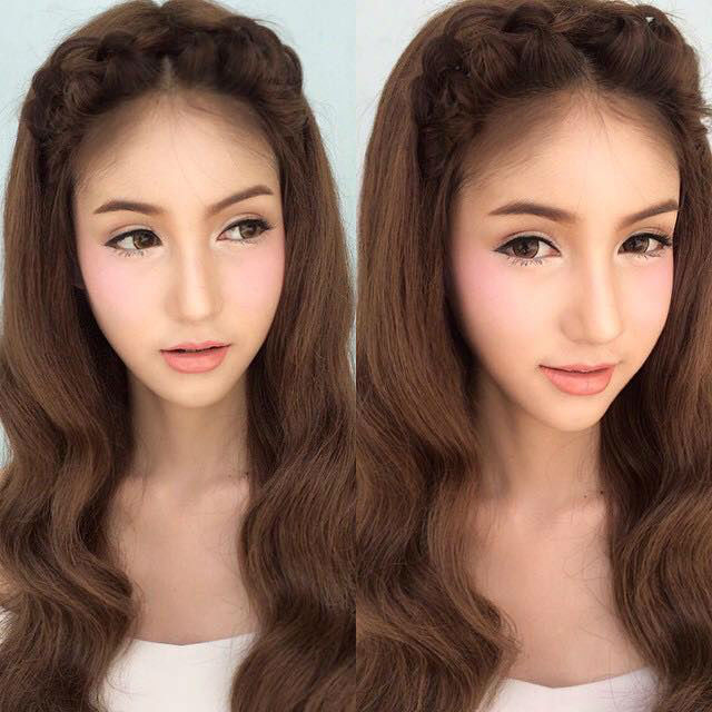 My Image 20