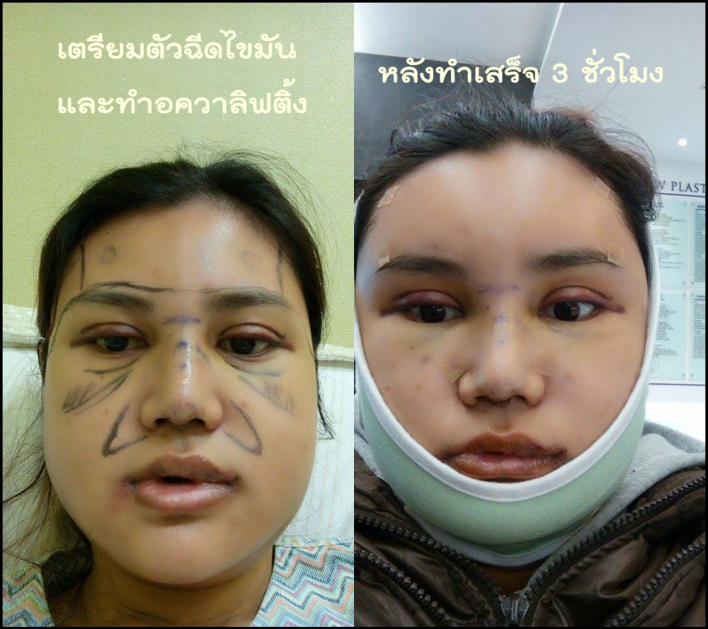 My Image 24