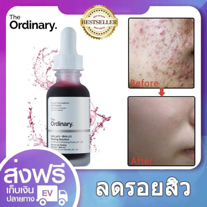 The Ordinary skincare ซื้อที่ไหน Pantip รีวิวเกาหลี