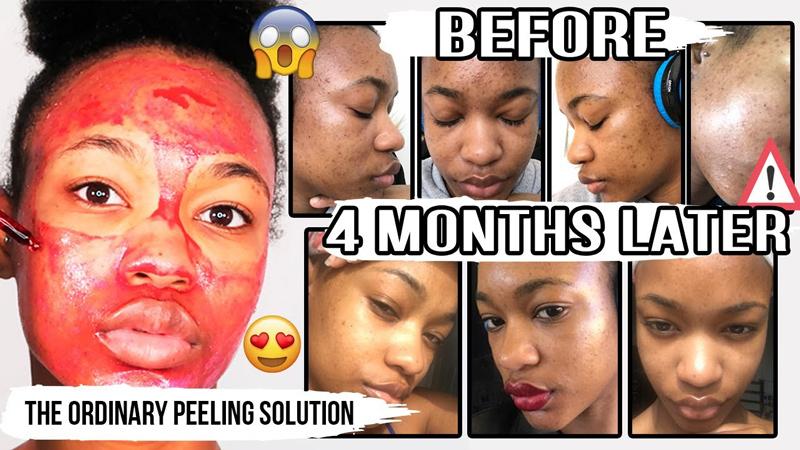 The Ordinary skincare ซื้อที่ไหน Pantip ร้านเกาหลี และอังกฤษ