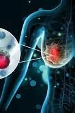 ปกนิยาย Arimidex pill | Best Treat For Breast Cancer