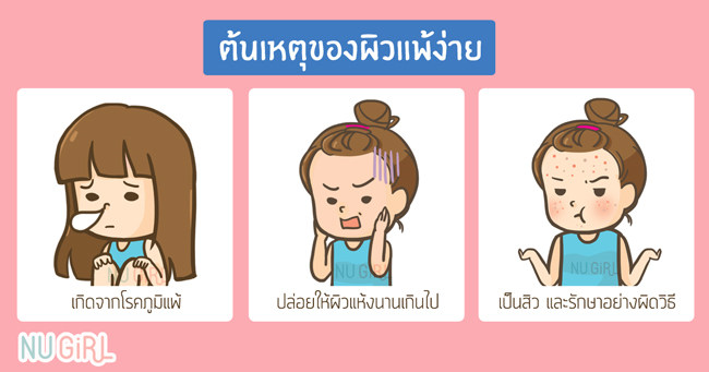 ไม่อยากแพ้ต้องสู้! รวมวิธีรับศึกผิวแพ้ง่าย