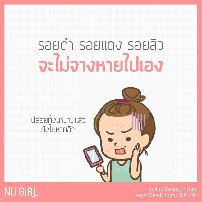 รอยสิวปล่อยทิ้งไว้ ไม่มีทางหายได้เอง